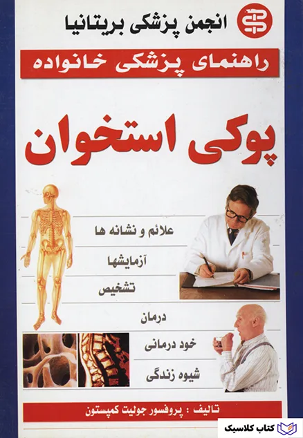 پوکی استخوان 2